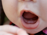 Các nguyên nhân khiến cho trẻ chậm mọc răng.