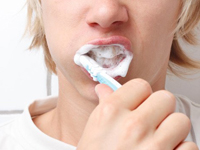 Tại sao đánh răng thường xuyên mà vẫn bị sâu?